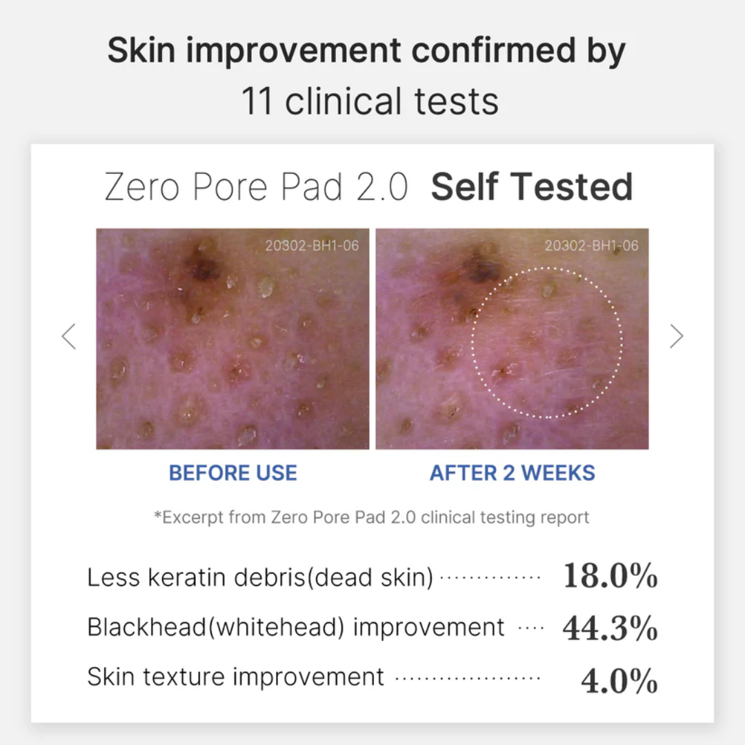 Zero Pore Pads 2.0